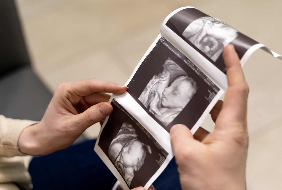 Hands hold a strip of ultrasound photos